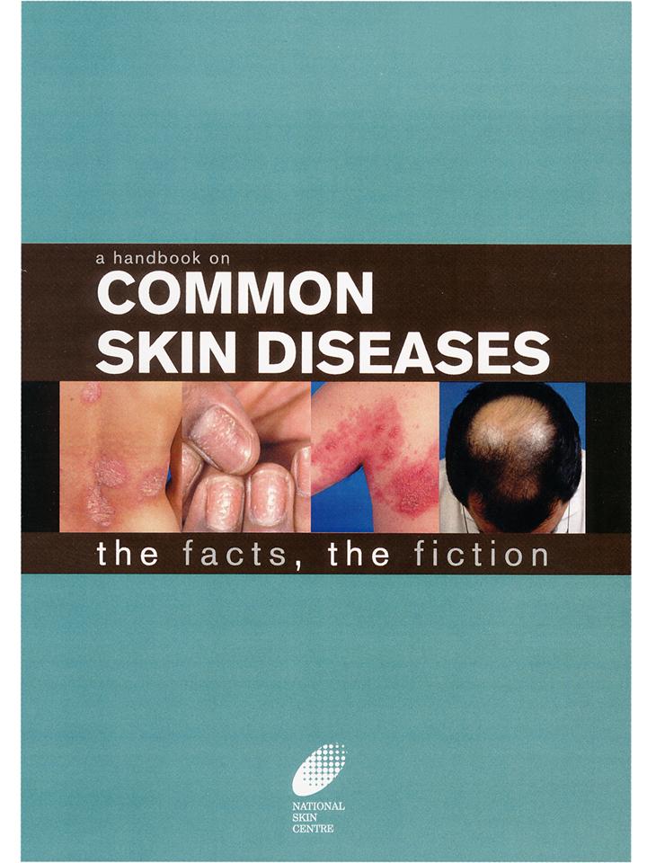 A Handbook on Common Skin Diseases (Revised Edition)  